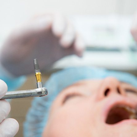 Closeup of oral surgeon holding implant about to be placed in patient’s mouth