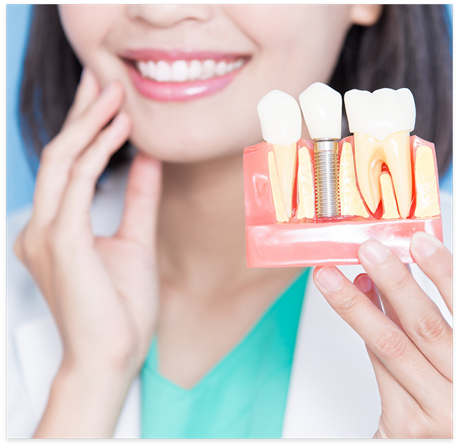 Close up of female dentist holding a dental implant model