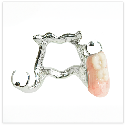 Partial denture with gum colored base and metal framework