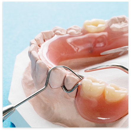 Partial dentures on a white model of teeth