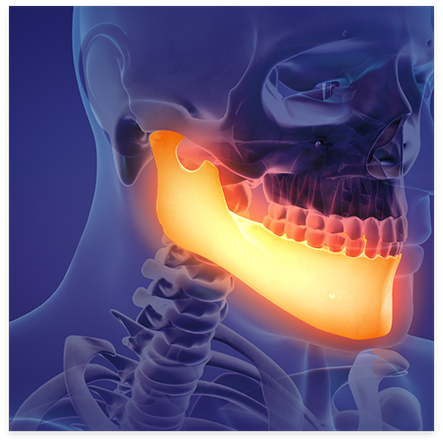 Illustration of x ray with jawbone highlighted