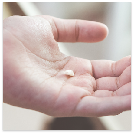 Hand holding a lost dental crown