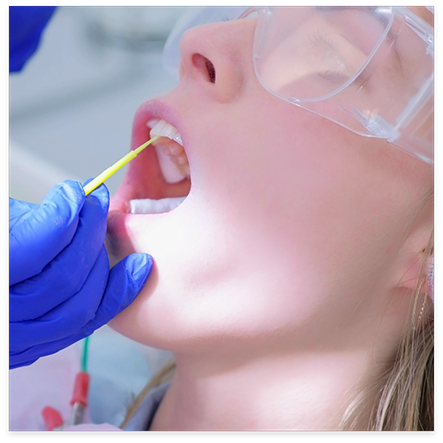 Close up of patient receiving fluoride treatment