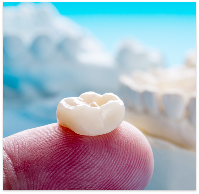 Close up of crown on finger for restorative dentistry in Cottonwood Heights