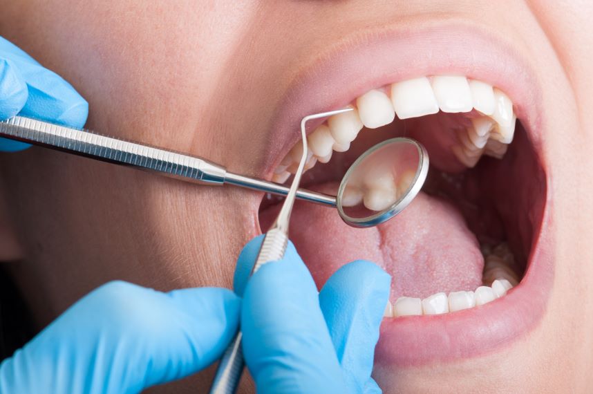 A woman getting her teeth cleaned by a dental hygienist.